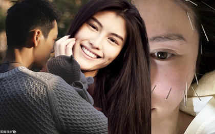 Vợ tổng tài hot nhất Trung Quốc ghim hàng chục cây kim lên mặt để ngăn xệ sau sinh