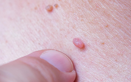 Phụ nữ từng quan hệ tình dục nên biết