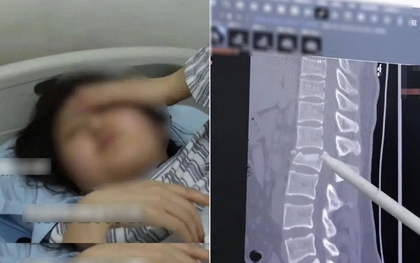 Dùng điện thoại khi làm 1 việc, cô gái có thể liệt 2 chân, tiểu không tự chủ suốt đời