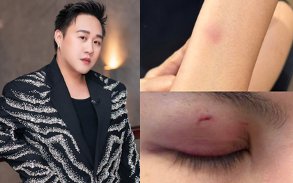 Mới nhất drama hành hung nữ bác sĩ: Trung Quân Idol thông báo ngưng hoạt động rồi xoá post sau 10 phút