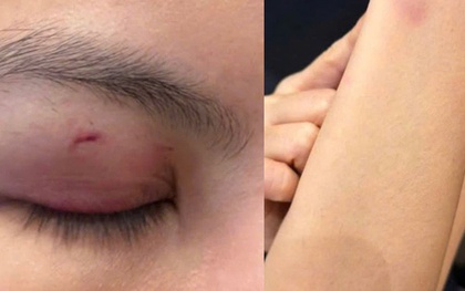 Luật sư nhận định vụ ca sĩ Trung Quân Idol bị tố đánh phụ nữ