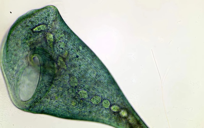 Sinh vật đơn bào Stentor coeruleus chứng minh rằng học hỏi có thể không cần dùng tới não