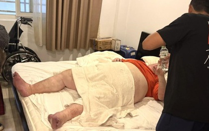 Du khách nặng gần 300 kg mắc kẹt trong nhà vệ sinh ở Đà Nẵng