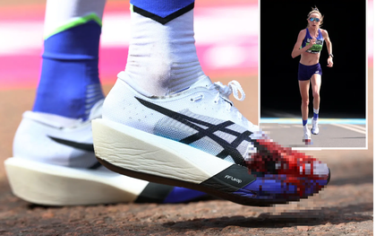 Ám ảnh hình ảnh bàn chân đẫm máu của ngôi sao điền kinh xinh đẹp