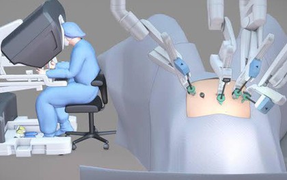 Mổ bằng robot có thực sự tốt hơn không?