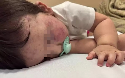 Bé trai 11 tháng tuổi tử vong sau 5 tiếng chờ bác sĩ, người mẹ đau khổ nói: "Lẽ ra con tôi có thể được cứu"