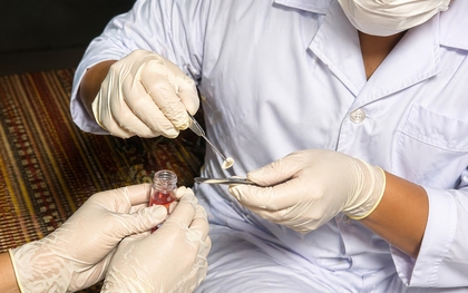 Món quà ánh sáng từ đôi giác mạc của người phụ nữ 61 tuổi