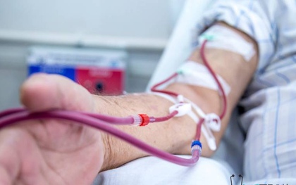Người đàn ông tử vong vì suy thận giai đoạn cuối, bác sĩ tiếc nuối: Thích uống trà, chăm thể dục nhưng mắc 1 sai lầm…