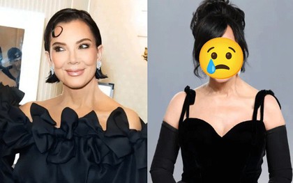 Bà trùm Kardashian chi 2,6 tỷ "cải lão hoàn đồng", ngờ đâu sau 1 năm phải nhận kết đắng