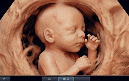 Bác sĩ nghẹn lòng trước mong muốn của sản phụ: "Bác… cố chụp cho con em một tấm ảnh thật đẹp… để làm kỷ niệm"