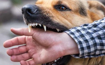 Sự cố thương tâm: Cụ ông 83 tuổi tử vong do chó nuôi trong nhà tấn công