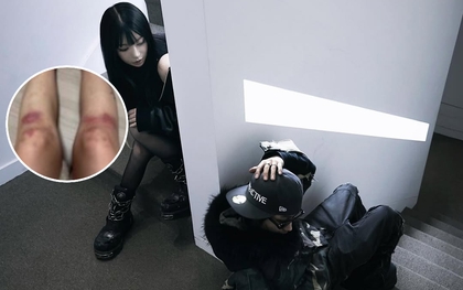 Nữ ca sĩ yêu lại bạn trai cũ từng đánh cô bầm dập toàn thân: “Tôi không kiện anh ấy nữa”