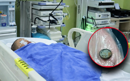 Bé trai 3 tuổi nuốt phải pin cúc áo, mẹ cho uống ngay 1 thìa gia vị, đến bệnh viện bác sĩ khen: "Giỏi lắm"