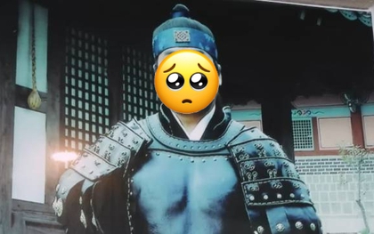 Sốc: Tài tử "Truyền Thuyết Jumong" mù mắt sau khi trượt chân ngã