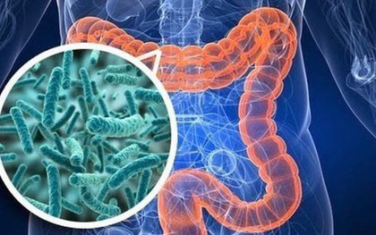 Những thói quen đang "nuôi dưỡng" ung thư đại trực tràng: Đừng xem nhẹ 4 tín hiệu cảnh báo từ cơ thể!