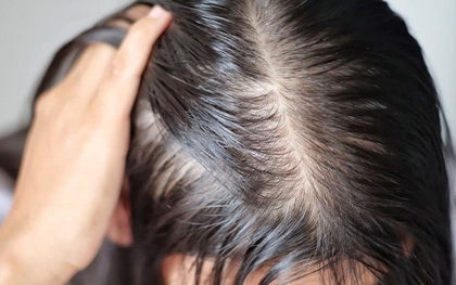 Lời khuyên cho những người hay bị rụng tóc