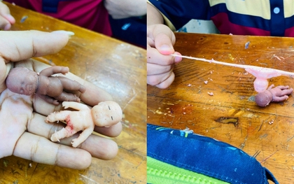 Trào lưu chơi “búp bê Natasha” khiến siêu mẫu Hà Anh lên tiếng: Rùng mình khi thấy trẻ xả stress bằng trò kéo đầu, bẻ chân tay búp bê