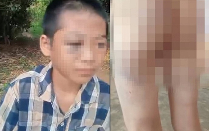 Chi tiết cực đắt trong vụ bé lớp 6 nghi bị mẹ kế và cha bạo hành: Chúng ta cần nhìn lại để dạy con mình!