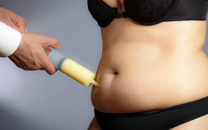 Hút mỡ ra ngoài rồi đem cấp đông bảo quản, đợi chờ làm đẹp trong tương lai: Cảnh báo trào lưu tiềm ẩn rủi ro