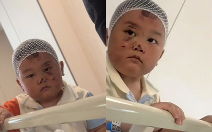 Bé trai 3 tuổi túc trực chăm mẹ sau tai nạn nghiêm trọng: Mặc dù chính bé bị nhiều vết thương đau đớn nhưng vẫn theo sát mẹ không rời