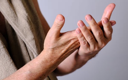 Muốn biết gan khỏe hay không, nhìn móng tay là biết: Thấy 4 dấu hiệu này phải đi khám ngay!