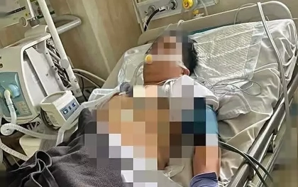 Nam sinh lớp 8 ở Lâm Đồng treo cổ tại nhà nghi bị bạo lực học đường
