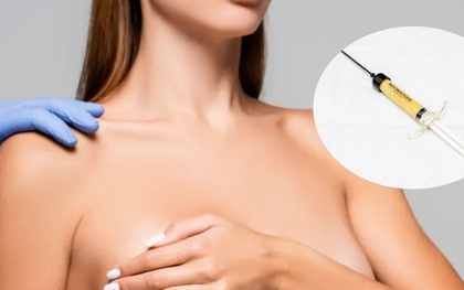 Phụ nữ "bơm mỡ người chết" vào ngực: Xu hướng thẩm mỹ mới khiến bác sĩ lo ngại nguy cơ sức khỏe