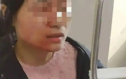 Cô giáo tiểu học bị đâm vỡ nhãn cầu vì can ngăn học sinh đánh nhau: Kẻ thủ ác không bị xử phạt vì chưa đủ 14 tuổi!