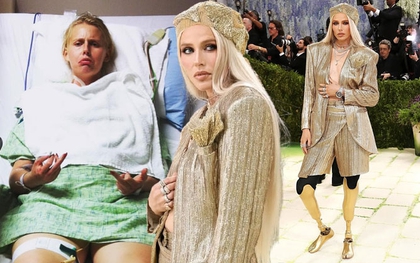 Nữ người mẫu bị cắt cụt chân, 14 năm sau mang chân giả đến đại náo Met Gala