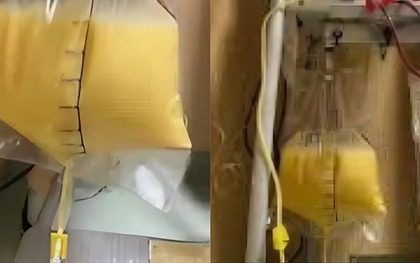 Người phụ nữ ra "máu trắng như sữa", bác sĩ lên tiếng cảnh báo