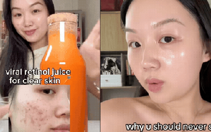 Để cứu làn da chi chít mụn, cô nàng Hàn Quốc uống loại nước ép đẹp da uống 2 lần/tuần, kết quả da đẹp ngoài sức tưởng tượng