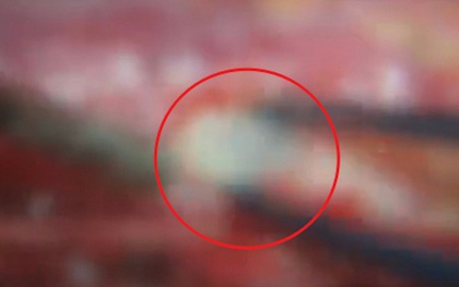 Người phụ nữ đau lưng suốt 2 năm, bác sĩ phát hiện ra bí mật "đáng sợ"