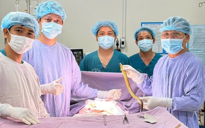 Lươn dài 50cm chọc thủng trực tràng, nằm ngoe nguẩy trong ổ bụng bệnh nhân