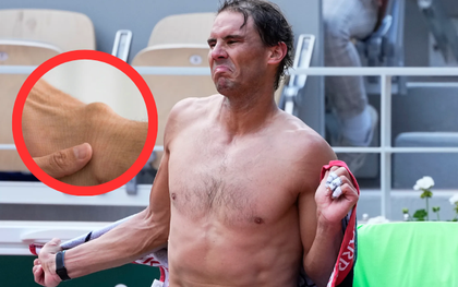 "Vua tennis" Rafael Nadal lộ bàn chân biến dạng vì căn bệnh hiếm