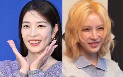 Nữ hoàng Kpop không còn trẻ đẹp?