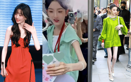 Tống Tổ Nhi gầy đến mức "da bọc xương": 5 mối nguy sức khỏe khi phụ nữ quá gầy