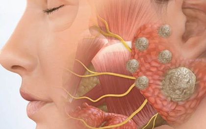 Có 1 dấu hiệu bất thường ở mặt, đi khám phát hiện hàng loạt vấn đề ở phổi, gan, thận, dạ dày