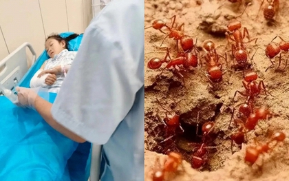 Bé 4 tuổi phát ban, tím tái, thở gấp sau khi bị kiến lửa đốt: Người mẹ làm ngay 4 việc này, bác sĩ cũng phải khen "làm rất tốt"