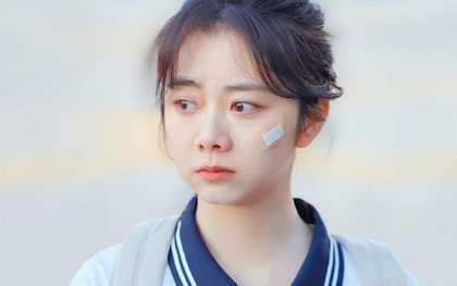 Đàm Tùng Vận gặp tai nạn nghiêm trọng khi quay phim, đôi môi gần như đứt lìa