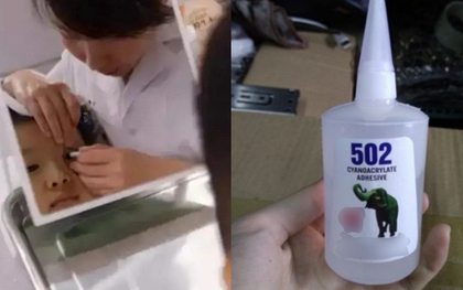 Cậu bé 3 tuổi bắt chước bà nhưng nhỏ nhầm keo 502 vào mắt: Mẹ sơ cứu trong 15 phút, bác sĩ nói "không cần điều trị nữa"