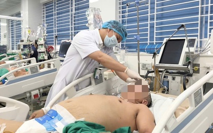 Tưởng mình khỏe mạnh, người đàn ông 45 tuổi xuất huyết não nguy kịch sau trận nhậu