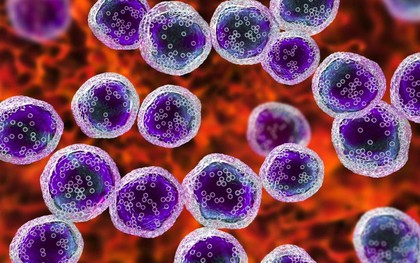 Một bệnh viện trung ương ghi nhận nhiều ca ung thư có chung một đặc điểm trên da