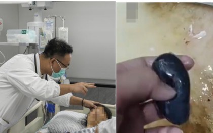 Người phụ nữ suy gan cấp vì mẹo dân gian chữa đau đầu, bác sĩ nói thẳng: Phần này của cá độc hơn thạch tín!