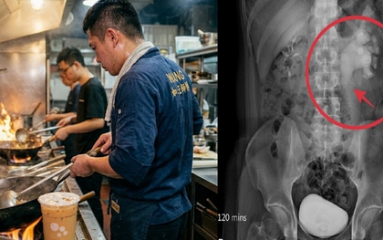 Nam đầu bếp 32 tuổi phù thận cấp tính vì 1 thói quen uống nước không ít người vẫn làm mỗi ngày