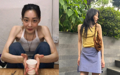 "Ngoại lệ" của Lee Min Ho giảm cân đến trơ xương, gầy đến độ chỉ khoảng 40kg