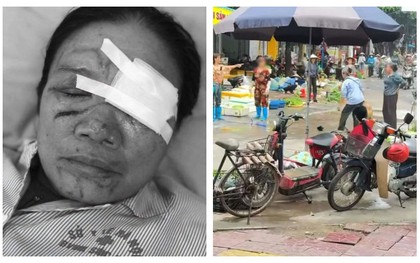 Người phụ nữ bán rau bị xịt nước, chảy máu mắt ở Phú Thọ: Con trai lên tiếng, mong làm rõ trách nhiệm