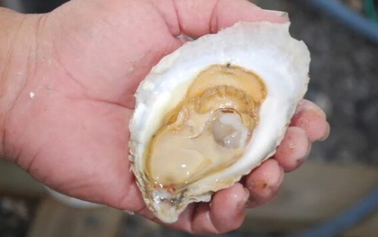 Người đàn ông 50 tuổi bị suy thận cấp sau khi ăn hàu sống