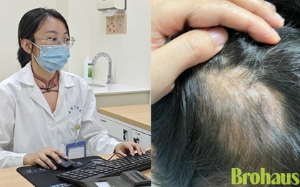 Một cái ôm với thú cưng, một mảng tóc không bao giờ mọc lại: Điều mọi ông bố có con nhỏ cần biết!