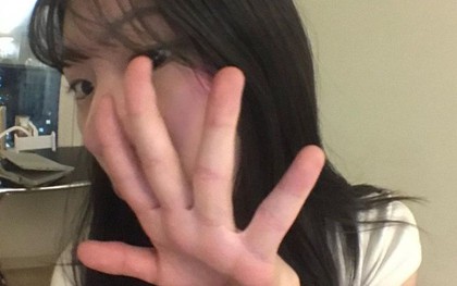 Các bác sĩ thừa nhận: Dấu hiệu nguy hiểm nhất của ung thư phổi KHÔNG PHẢI ho, mà là 5 thứ…