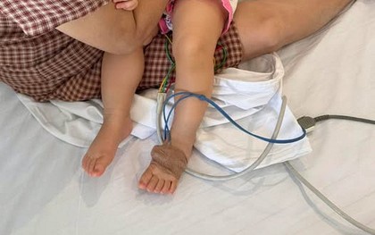 Mẹ chia sẻ bài học xương máu khi con bị sốc phản vệ khi truyền dịch: "Không ngờ mạng sống của con có lúc chỉ còn tính bằng phút"